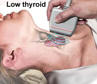 best weight for low thryoid 